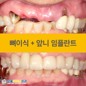서울바로본치과