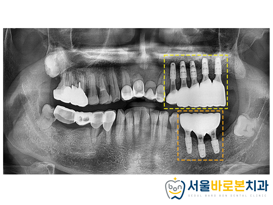 금광동치과