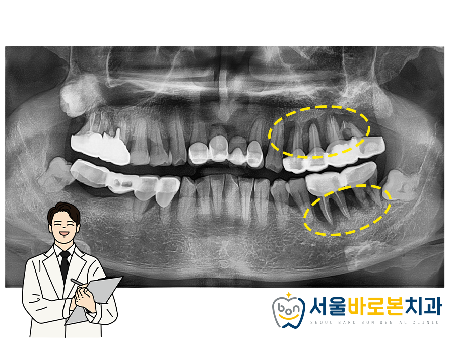 금광동임플란트