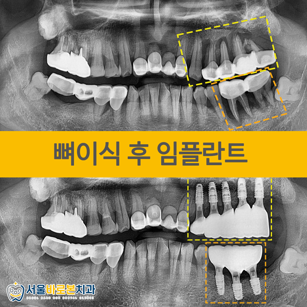 금광동치과
