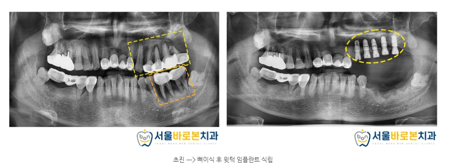 금광동치과