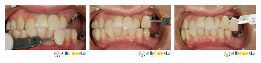 금광동치과