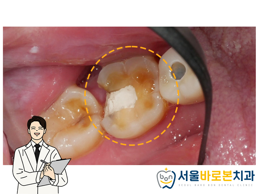 금광동임플란트