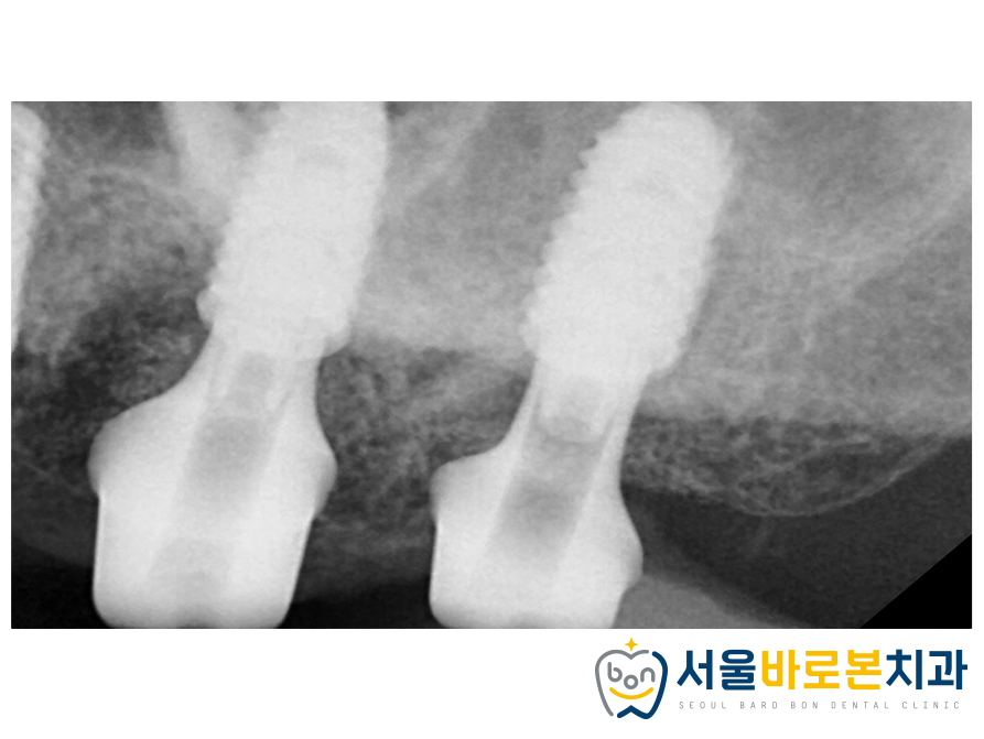 금광동치과