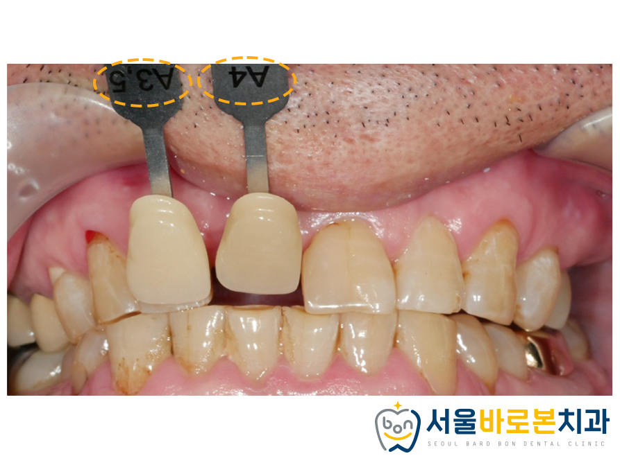 금광동치과