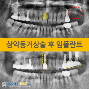 금광동치과