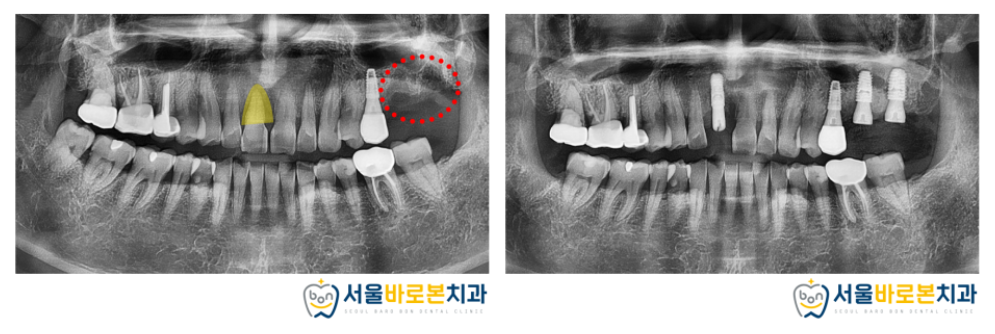 금광동치과